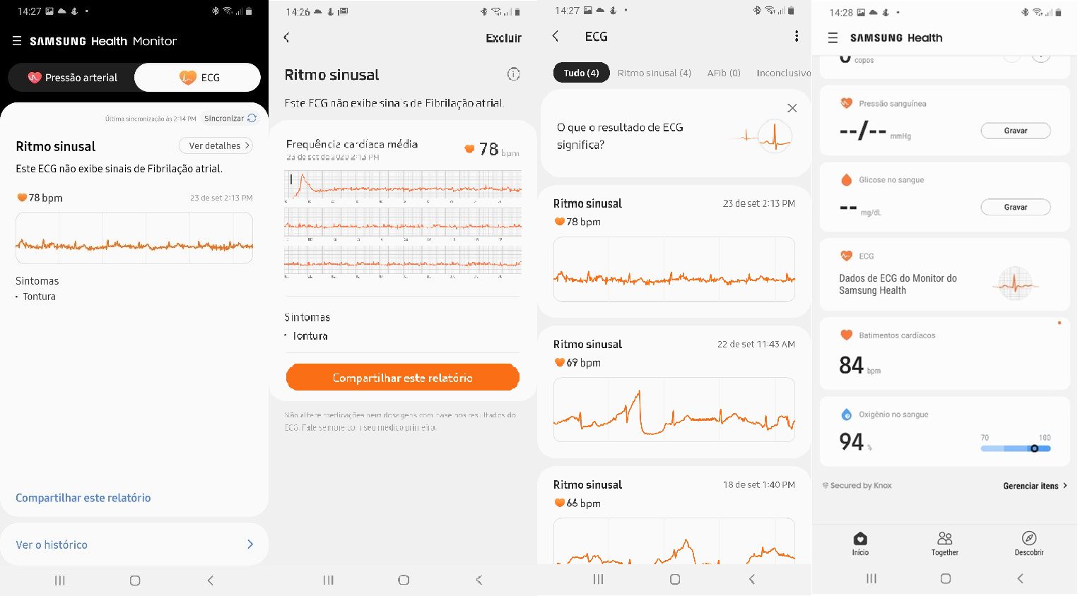 Novo aplicativo Samsung Health Monitor realiza medição de pressão e eletrocardiograma 5